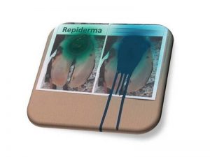 Repiderma will not run unlike iodine sprays
